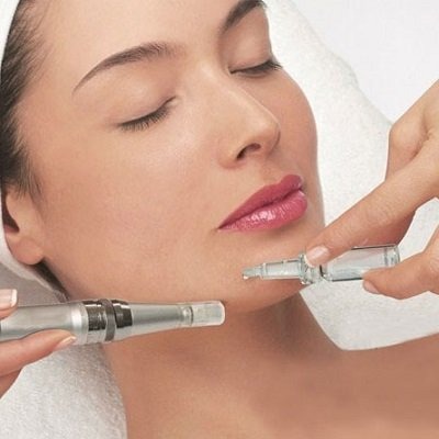 Dermapen Treatment in Peshawar, Mardan & KPK Glamorous Clinic