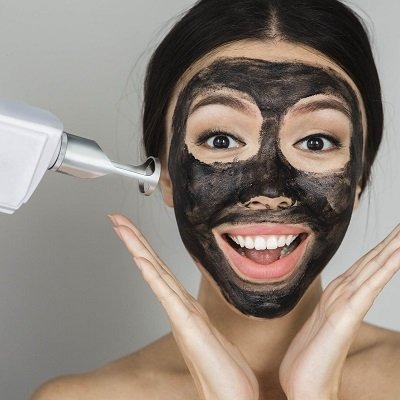 Laser Carbon Peel in Peshawar, Mardan & KPK Glamorous Clinic