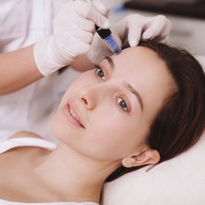 Microneedling for Acne Scars in Peshawar & Mardan Glamorous clinic