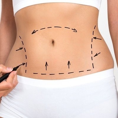 Non-Invasive Fat Removal in Peshawar & Mardan Cost and Price