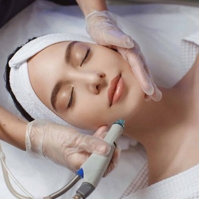 Pico Laser Treatment in Peshawar, Mardan & KPK Glamorous clinic